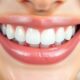 sensitive teeth whitening strips